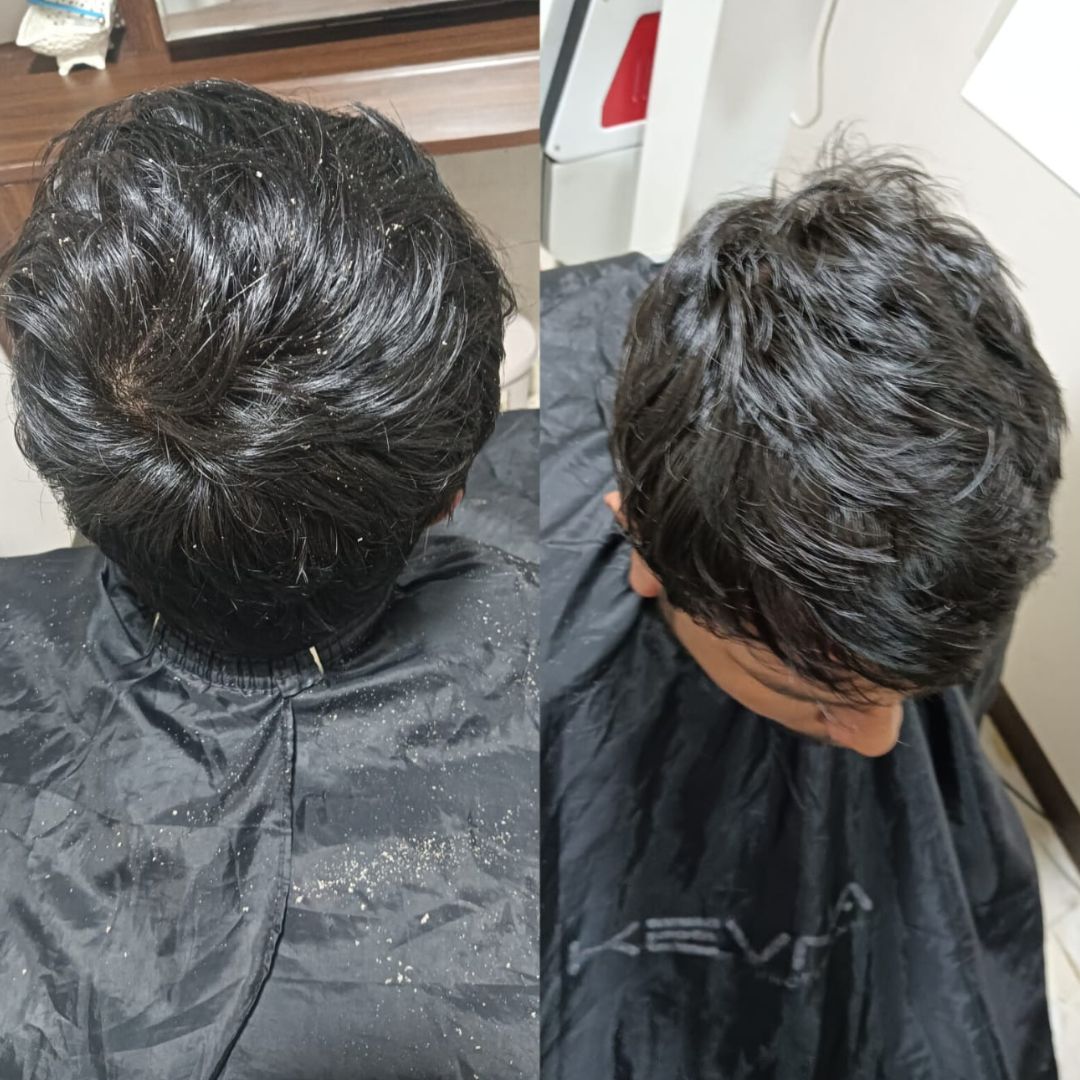 After treatment