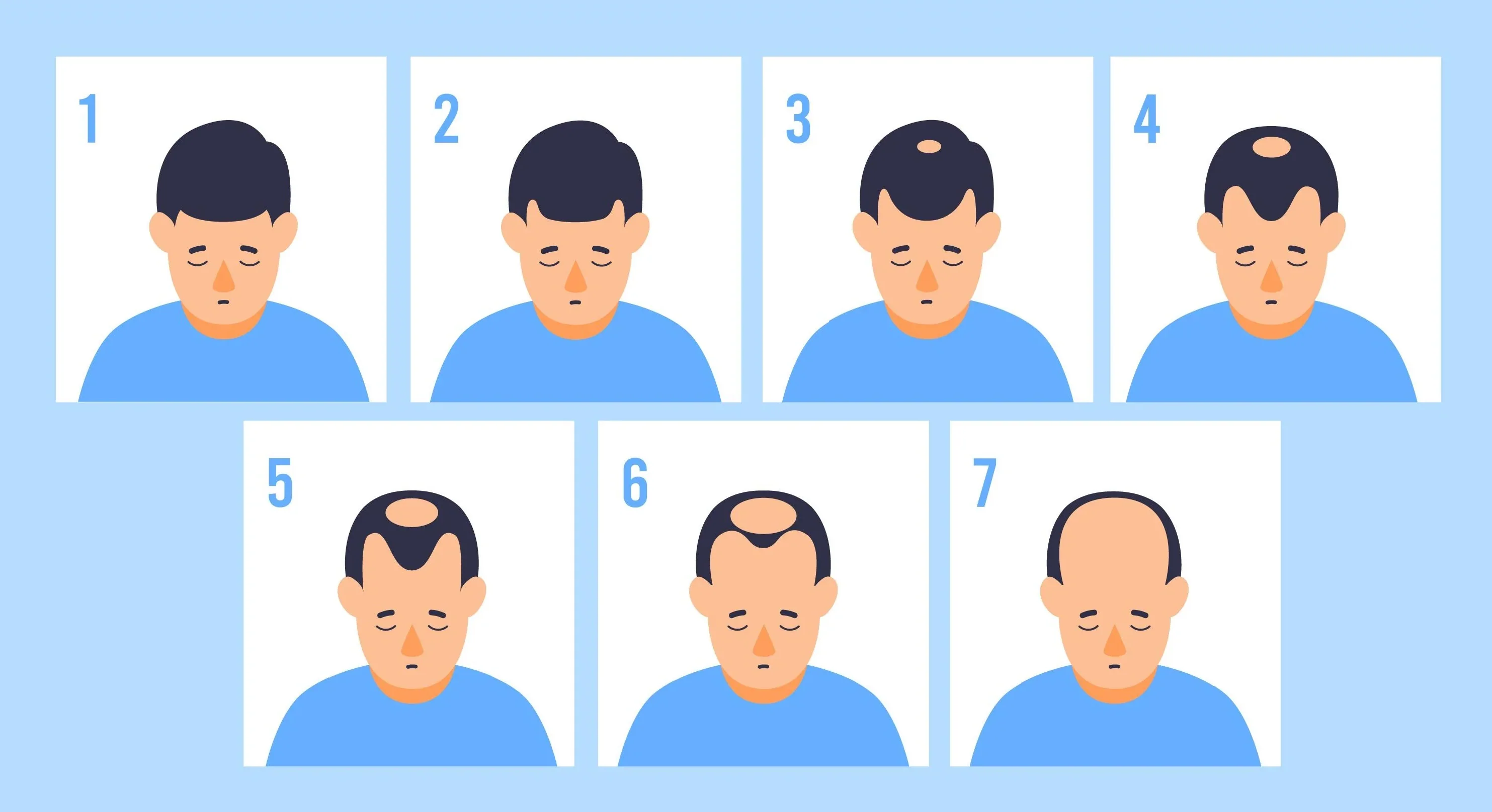 Norwood Baldness Scale